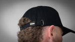 DISRUPTED CAP VISIBLE